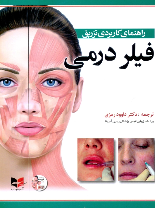 راهنمای کاربردی تزریق فیلر درمی رمزی آبادیس طب