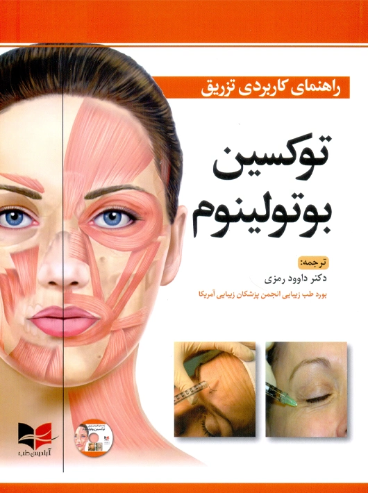 راهنمای کاربردی تزریق توکسین بوتولینوم رمزی آبادیس طب